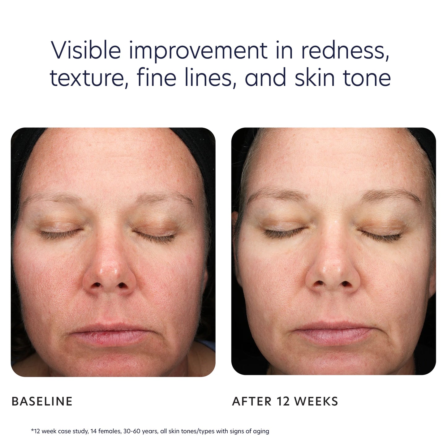 Triple Exfoliation Peel Pads